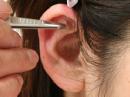 新メニュー追加　　鍼灸全身治療＋耳つぼ療法